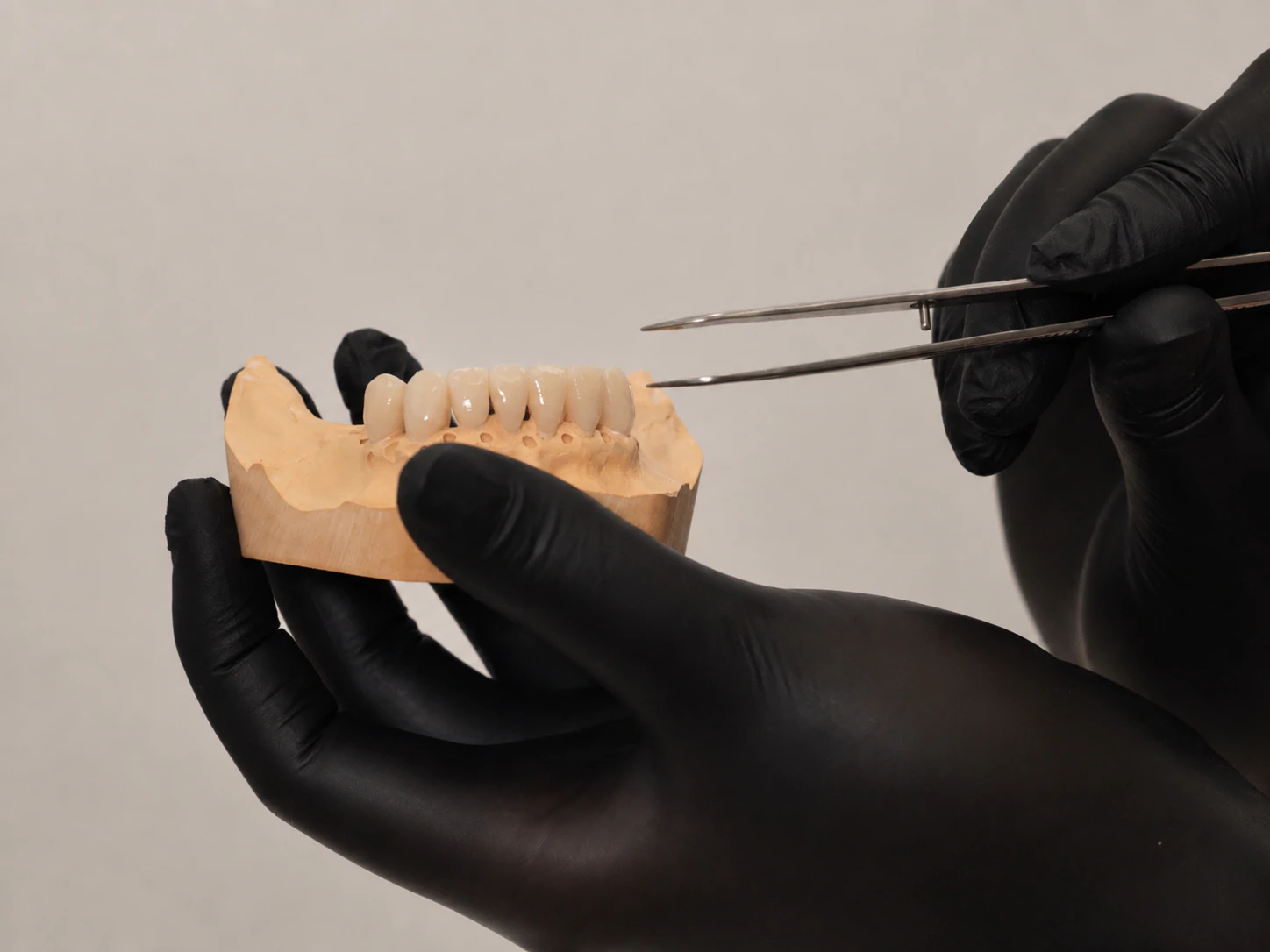 Коронки на зуботехнической модели и пинцет